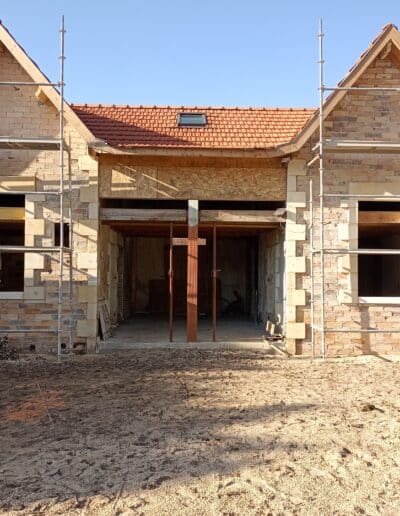 Restauration d'une canaulaise en cabinet dentaire Lacanau