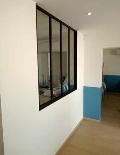 Restauration d'une canaulaise en cabinet dentaire Lacanau